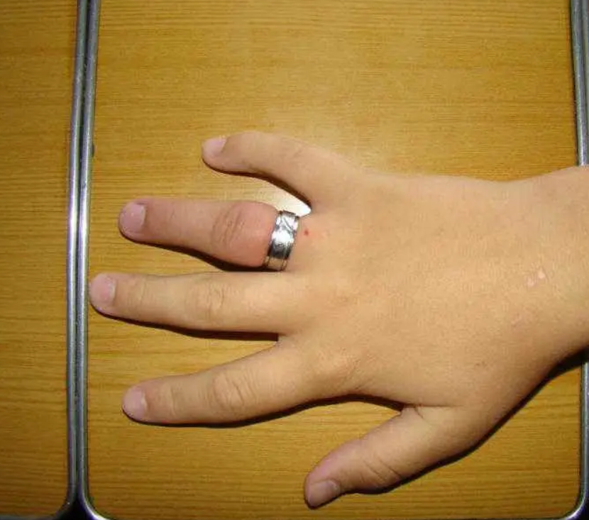 οι-λόγοι-που-η-βέρα-μπορεί-να-θέσει-σε-κίνδυνο-την-υγεία-μας- οι-λόγοι-που-η-βέρα-μπορεί-να-θέσει-σε-κίνδυνο-την-υγεία-μας-