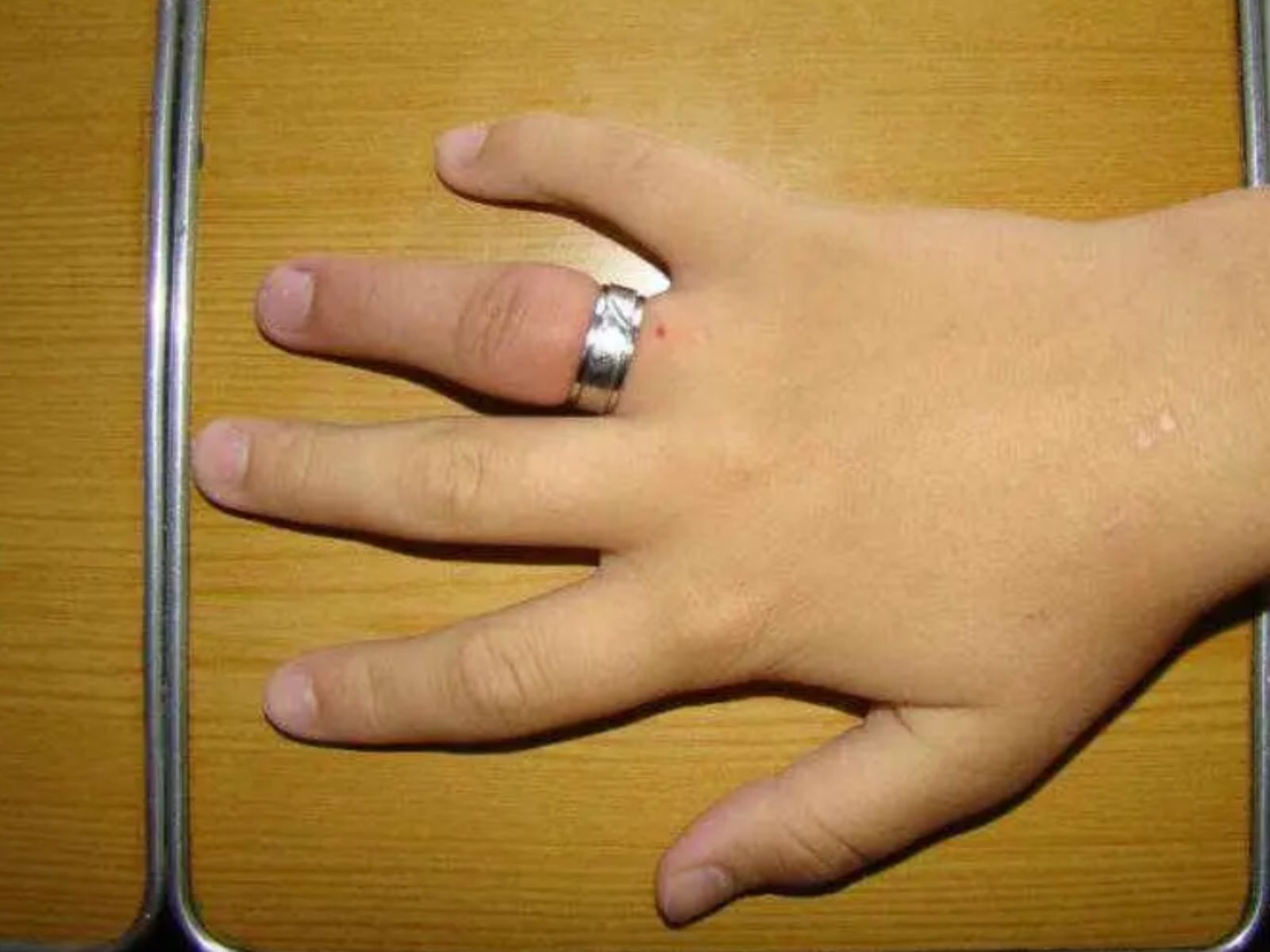 οι-λόγοι-που-η-βέρα-μπορεί-να-θέσει-σε-κίνδυνο-την-υγεία-μας-