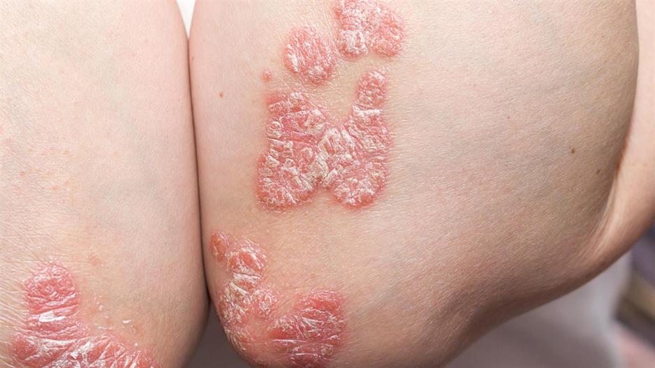 οι-πιο-επικίνδυνες-ασθένειες-για-το-2025- οι-πιο-επικίνδυνες-ασθένειες-για-το-2025-