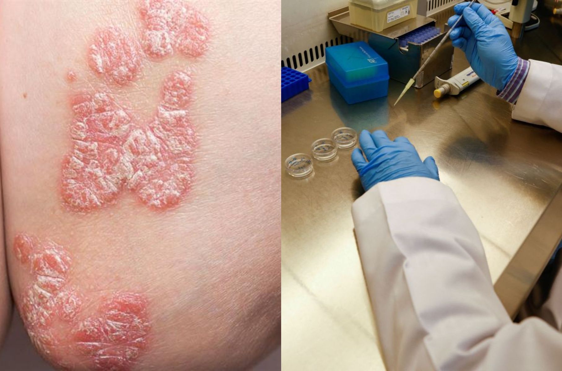 οι-πιο-επικίνδυνες-ασθένειες-για-το-2025-