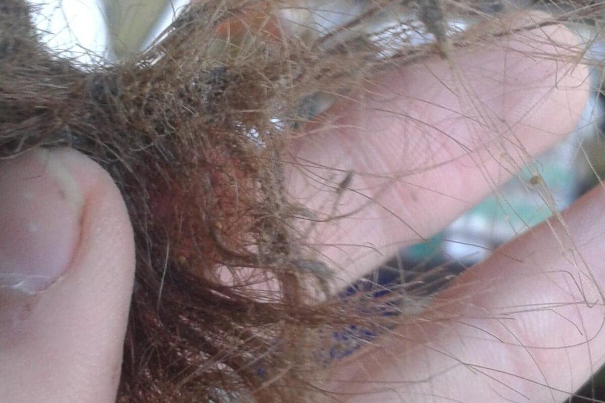 Μούχλα στα μαλλιά: Ο Λόγος που δεν πρέπει να κοιμόμαστε με βρεγμένα μαλλιά