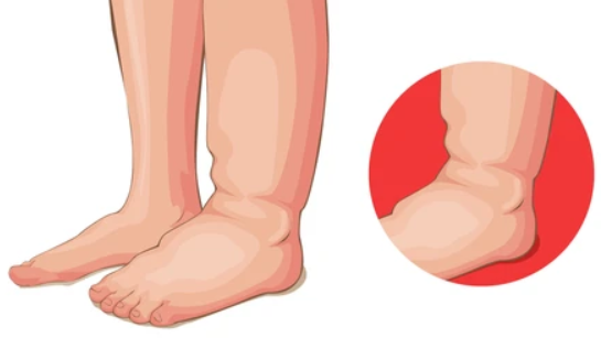 εβδομαδιαίο-πλάνο διατροφής-για-κατακράτηση-και-φούσκωμα- εβδομαδιαίο-πλάνο διατροφής-για-κατακράτηση-και-φούσκωμα-