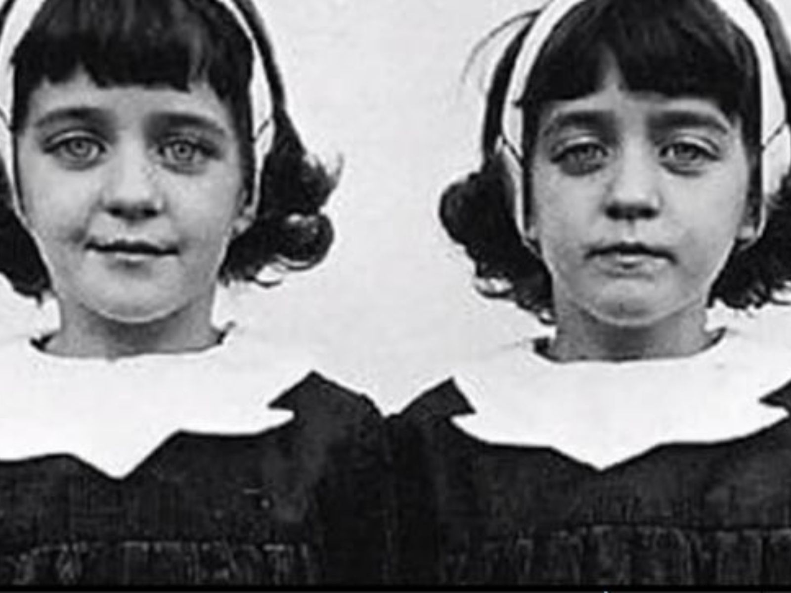 Η Υπόθεση μετενσάρκωσης των διδύμων που συγκλόνισε τη Μεγάλη Βρετανία