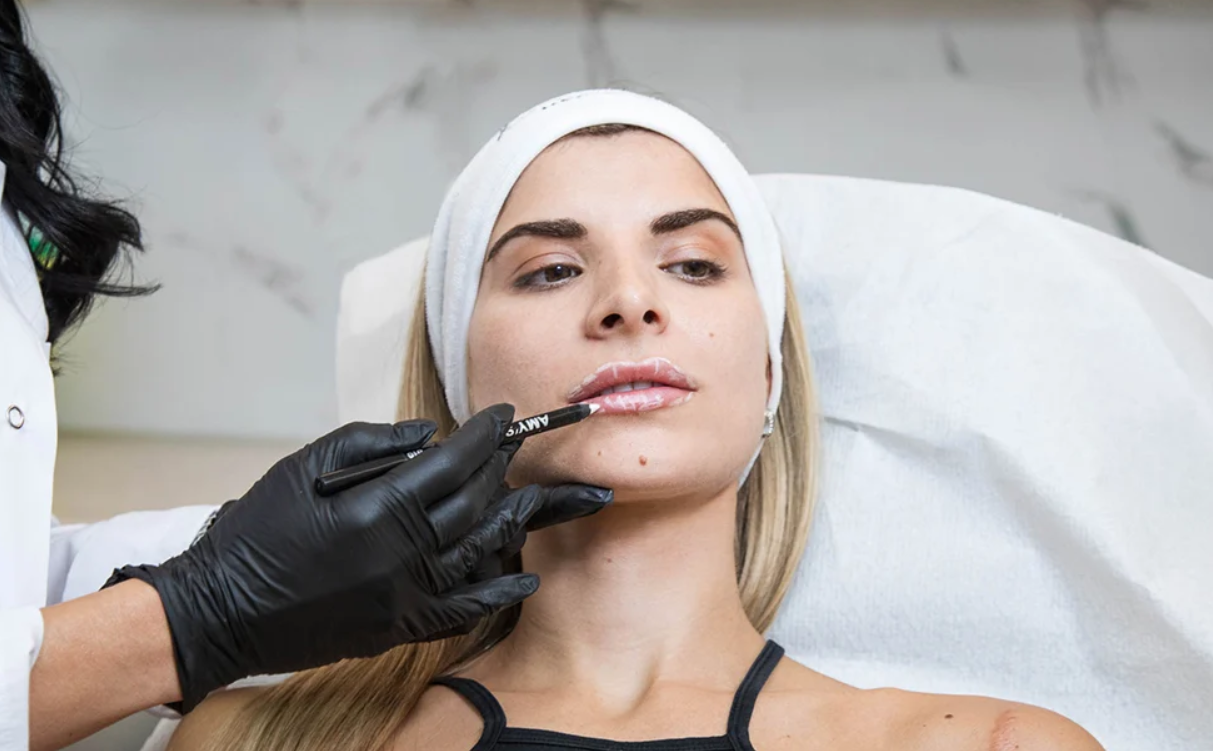 η-17χρονη κόρη-μου-θέλει-να-κάνει-υαλουρονικό-στα-χείλη- η-17χρονη κόρη-μου-θέλει-να-κάνει-υαλουρονικό-στα-χείλη-