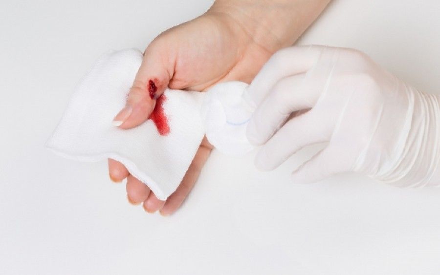 Οξυζενέ: Το μαγικό συστατικό που δεν πρέπει να λείπει από κανένα σπίτι- Οι 32 διαφορετικές χρήσεις του(Δεν είναι έτοιμο)