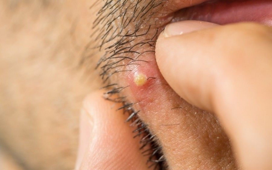 Οξυζενέ: Το μαγικό συστατικό που δεν πρέπει να λείπει από κανένα σπίτι- Οι 32 διαφορετικές χρήσεις του(Δεν είναι έτοιμο)