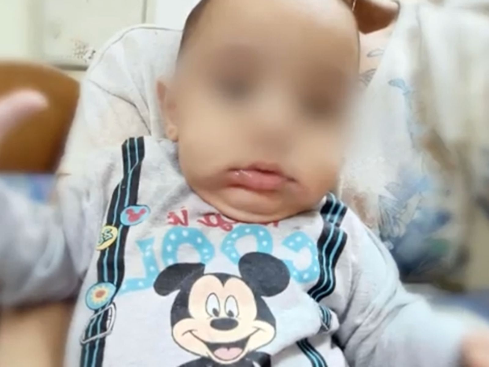 Οι τελευταίες σοκαριστικές φωτογραφίες του μικρού Παναγιωτάκη δείχνουν κακώσεις- Δεν τις κατέγραψε ο ιατροδικαστής Κ.Γκότσης