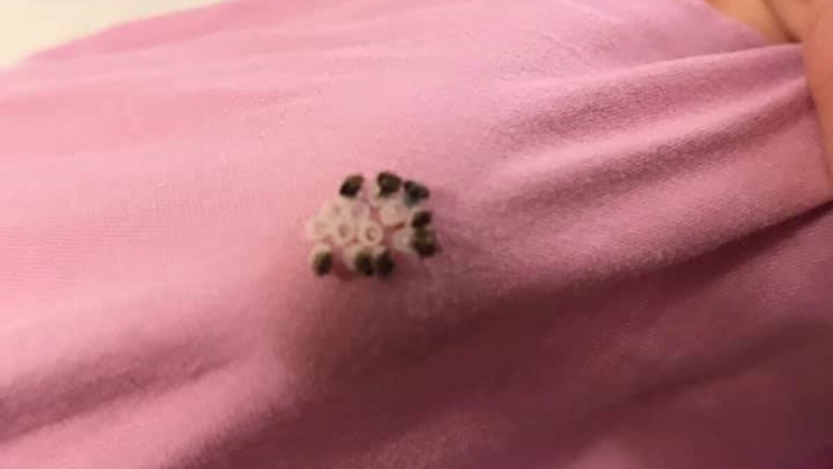 Τι είναι αυτά τα αηδιαστικά αυγά που μπορείτε να βρείτε στα απλωμένα ρούχα σας- Μάθετε και διώξτε τα με φυσικούς τρόπους