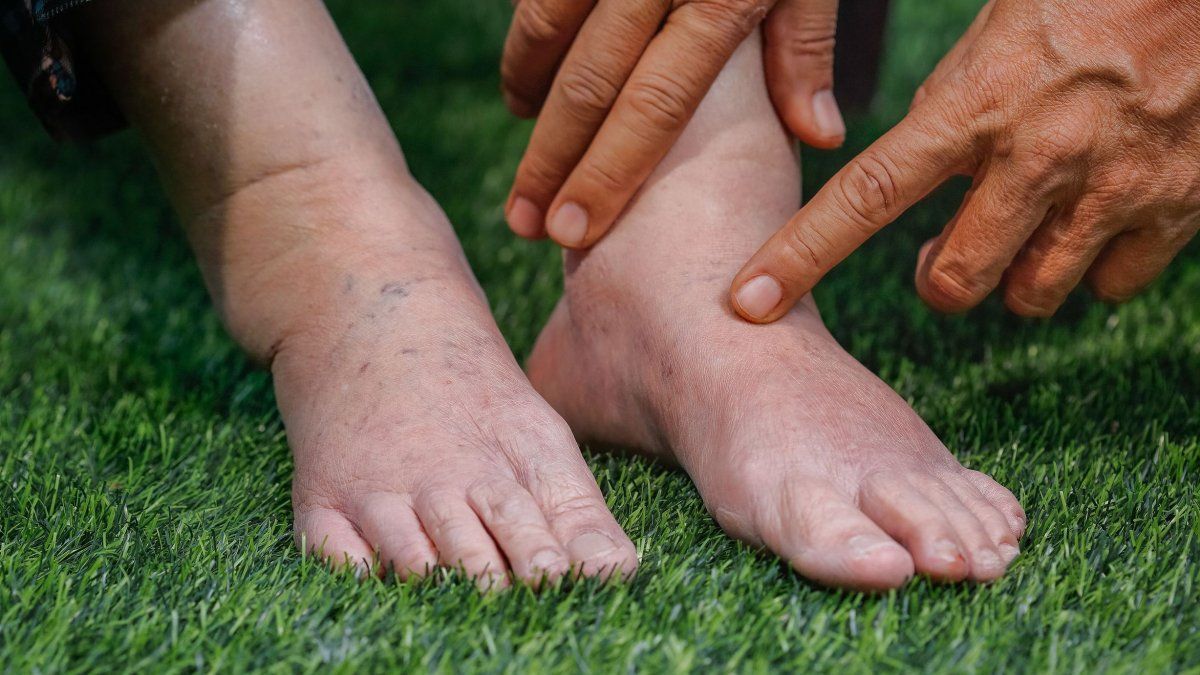 6 σημάδια που μαρτυρούν ότι δεν λαμβάνετε αρκετή πρωτεΐνη