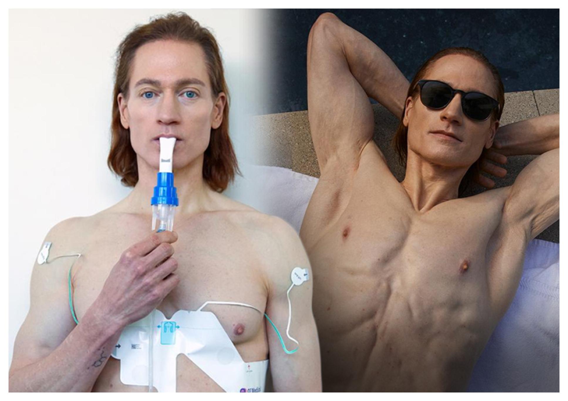 Μπράιαν Τζόνσον: Πρόωρη γήρανση για το μεγιστάνα που πάλευε να κερδίσει την αθανασία