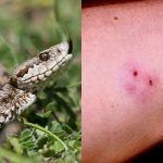 Τσίμπημα από φίδι: Οι πρώτες βοήθειες μέχρι να φτάσεις στο νοσοκομείο