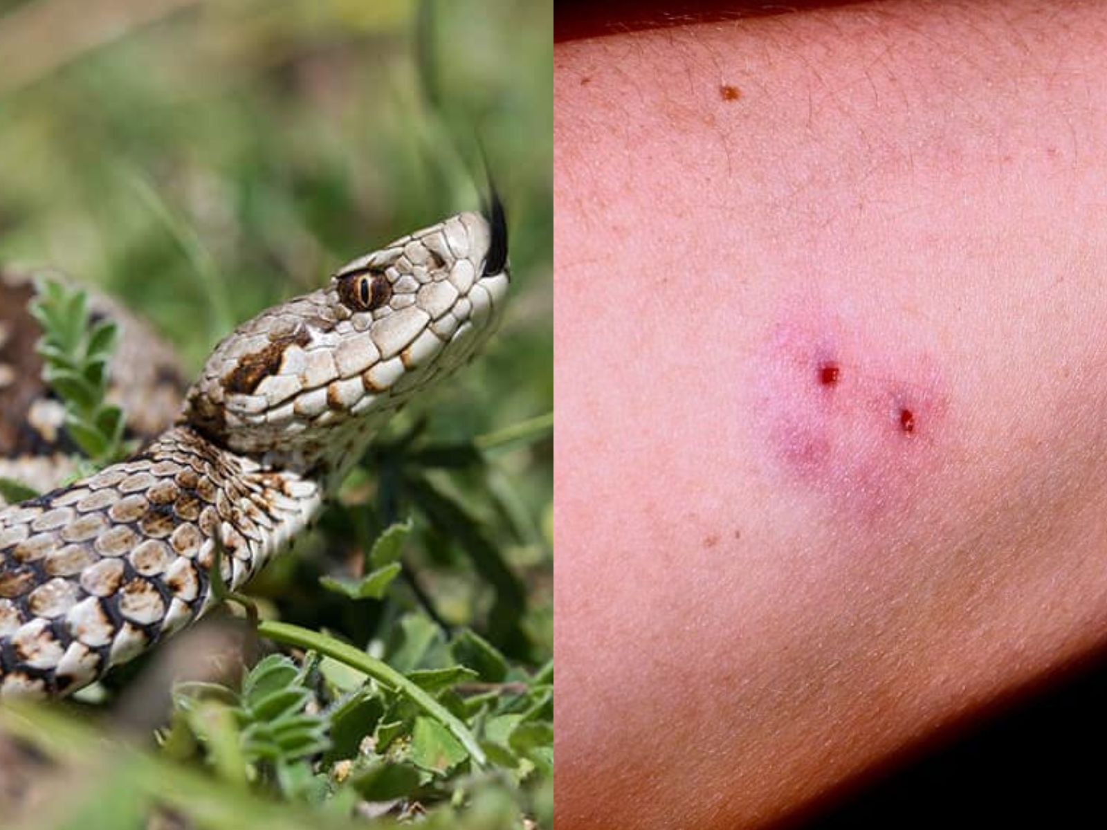 Τσίμπημα από φίδι: Οι πρώτες βοήθειες μέχρι να φτάσεις στο νοσοκομείο