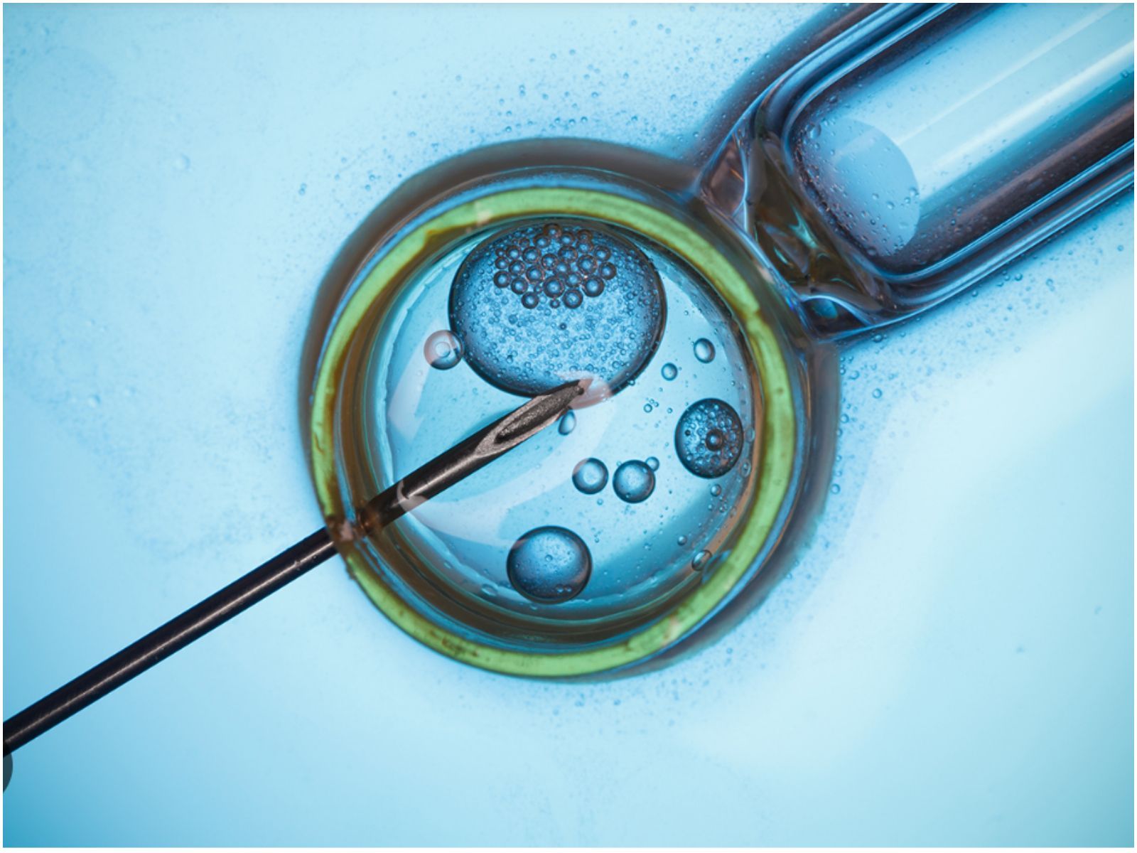 Είναι γεγονός- Γεννήθηκε το πρώτο μωρό που συνελήφθη με τεχνητή νοημοσύνη