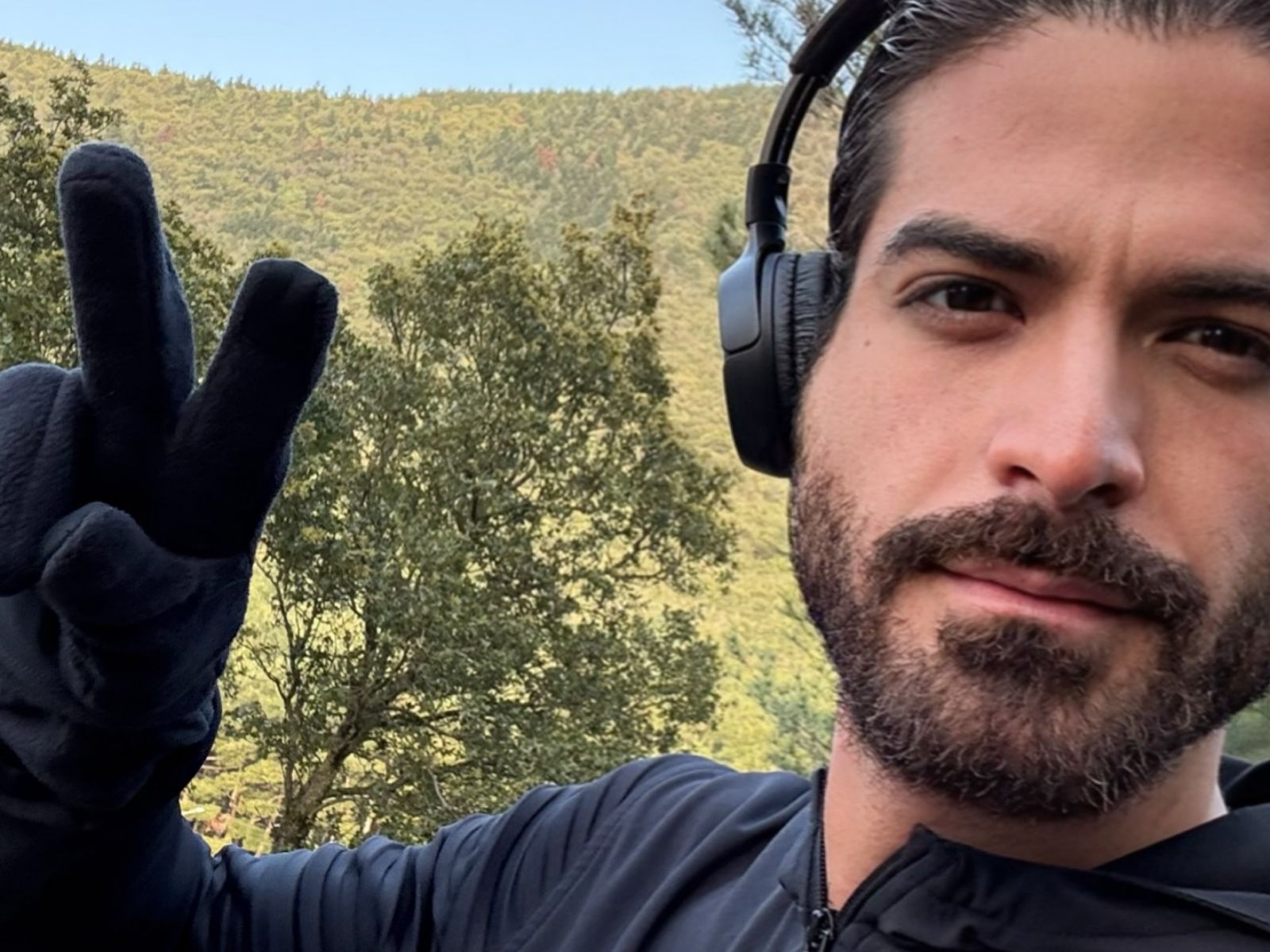 Άρης Μουγκοπέτρος: Oι γιατροί προχώρησαν σε ακρωτηριασμό μετά τον τραυματισμό από κροτίδα