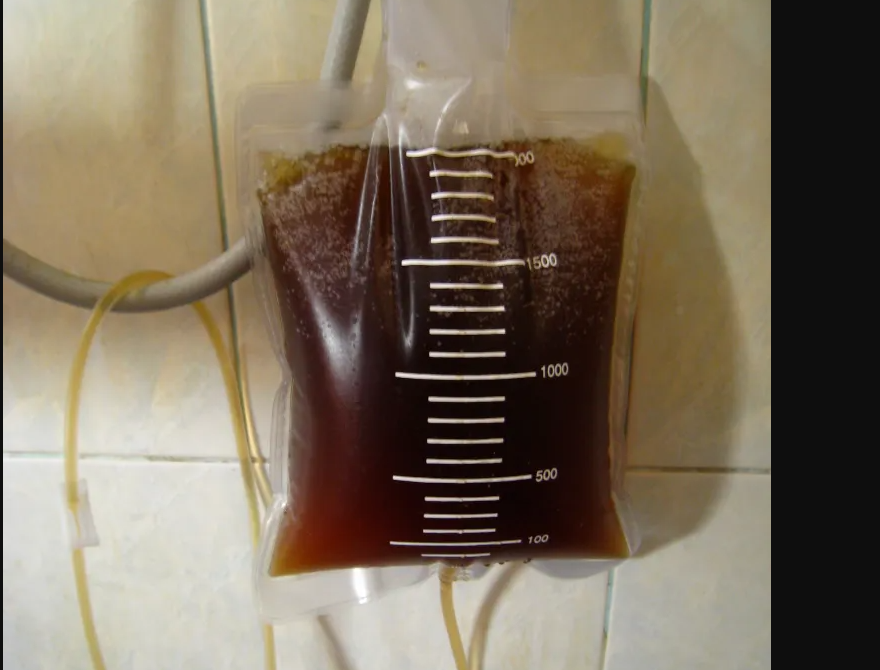 Κλύσμα καφέ: Ο τρόπος αποτοξίνωσης του βασιλιά Κάρολου και της Γκουίνεθ Πάλτροου – Έχει όντως αποτελέσματα;