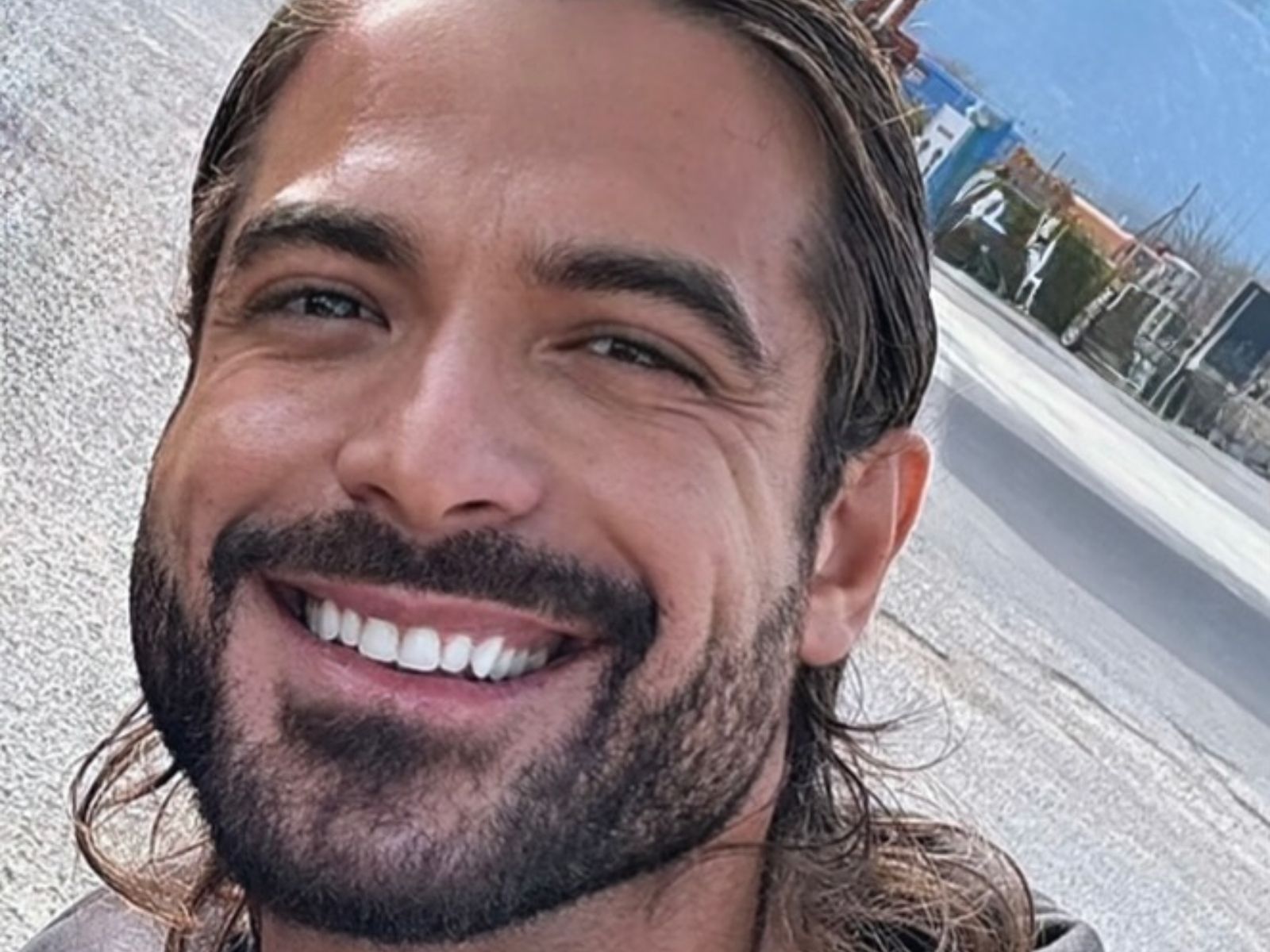 Αρής Μουγκοπέτρος : Νέος γολγοθάς για τον μουσικό- Σχεδόν τυφλώθηκε