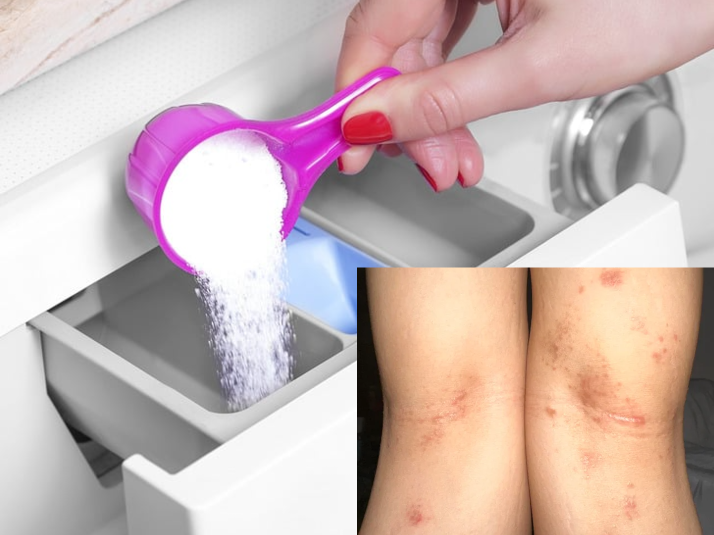 Χημικά κατάλοιπα στα ρούχα- Μη χρησιμοποιείτε αυτό το απορρυπαντικό, μπορεί να προκαλέσει βλάβες στο δέρμα σας