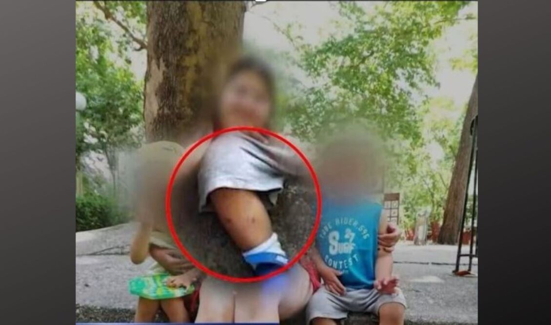 Λάρισα: Η 32χρονη μητέρα έχει κι άλλο παιδί από το οποίο έχει χάσει την επιμέλεια- Η ανατριχιαστική κατάθεση της παιδιάτρου