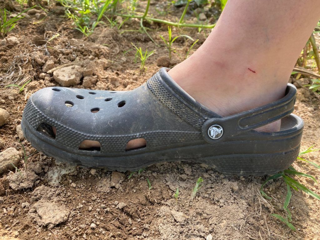 Πώς να μην μυρίζουν άσχημα τα Crocs το Καλοκαίρι