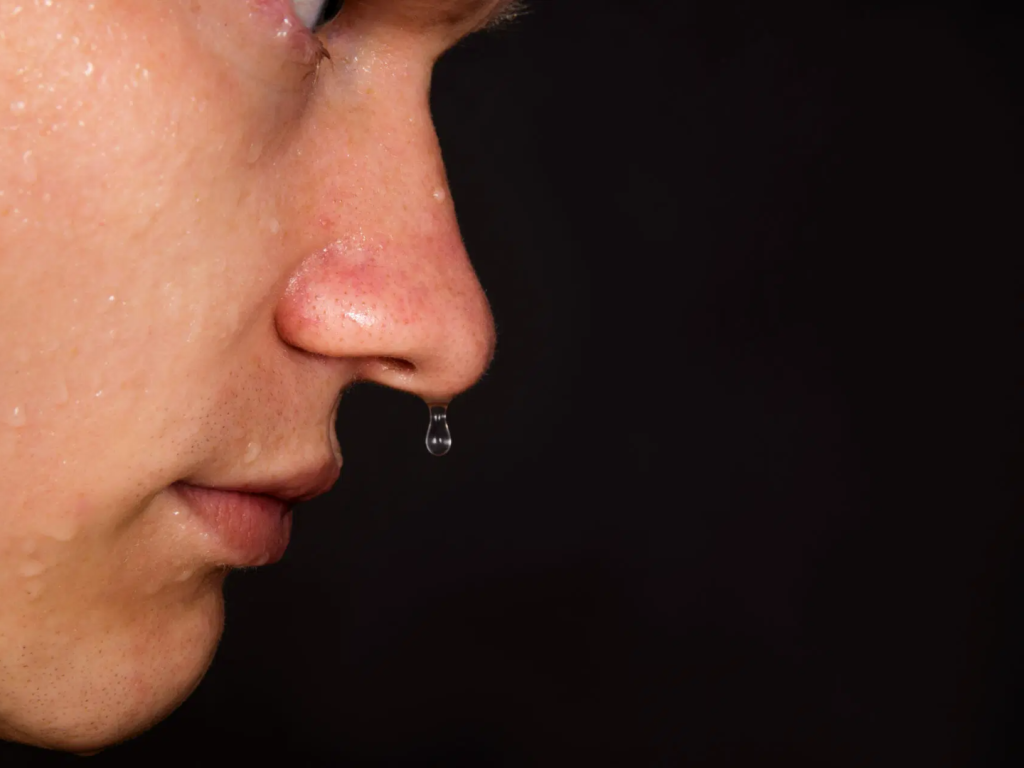 Γιατί τρέχει σαν νερό από τη μύτη μου;