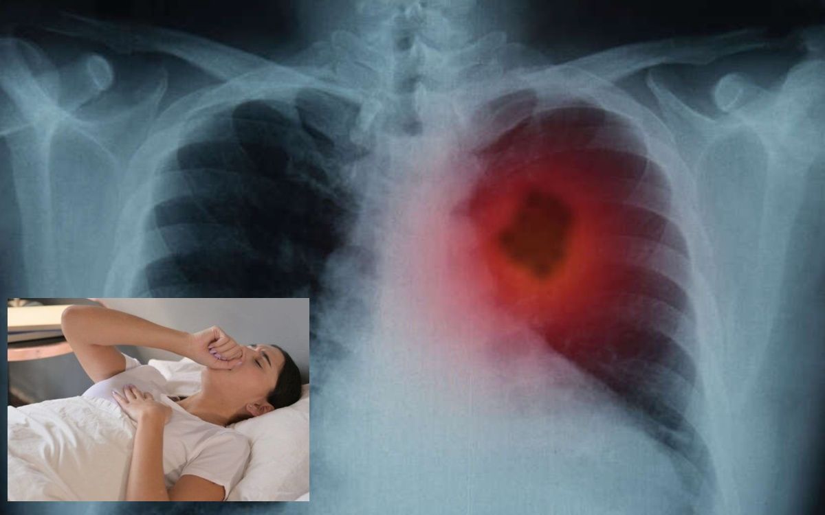 ακτινογραφία-πνεύμονα-με-όγκο-και-γυναίκα-που-βήχει-
