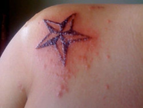 Γιατί απαγορεύεται να κάνετε τατουάζ το Καλοκαίρι και πως να το προστατεύσετε αν έχετε ήδη Γιατί απαγορεύεται να κάνετε τατουάζ το Καλοκαίρι και πως να το προστατεύσετε αν έχετε ήδη