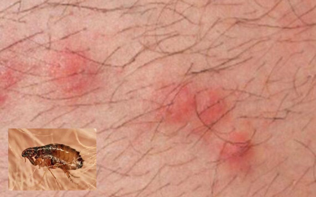 Ο κήπος "βράζει" από ψύλλους το Καλοκαίρι - Πώς να απαλλαγείς οριστικά