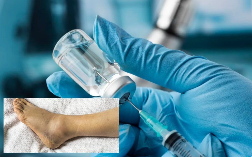 Κορτιζόνη - Οι παρενέργειες του φαρμάκου και σε ποιες περιπτώσεις χορηγείται