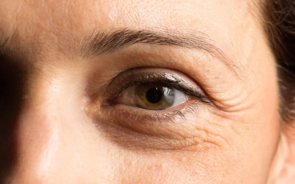 Ξέχνα το botox και τις πλαστικές - Επιστήμονες βρήκαν το φάρμακο που σταματάει τη γήρανση