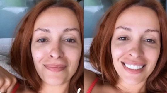 Οι πιο εντυπωσιακές εμφανίσεις Ελληνίδων celebrities χωρίς μακιγιάζ – Φωτογραφίες που έγιναν viral