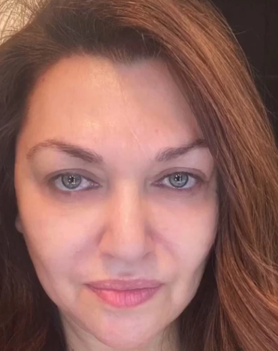 Οι πιο εντυπωσιακές εμφανίσεις Ελληνίδων celebrities χωρίς μακιγιάζ – Φωτογραφίες που έγιναν viral