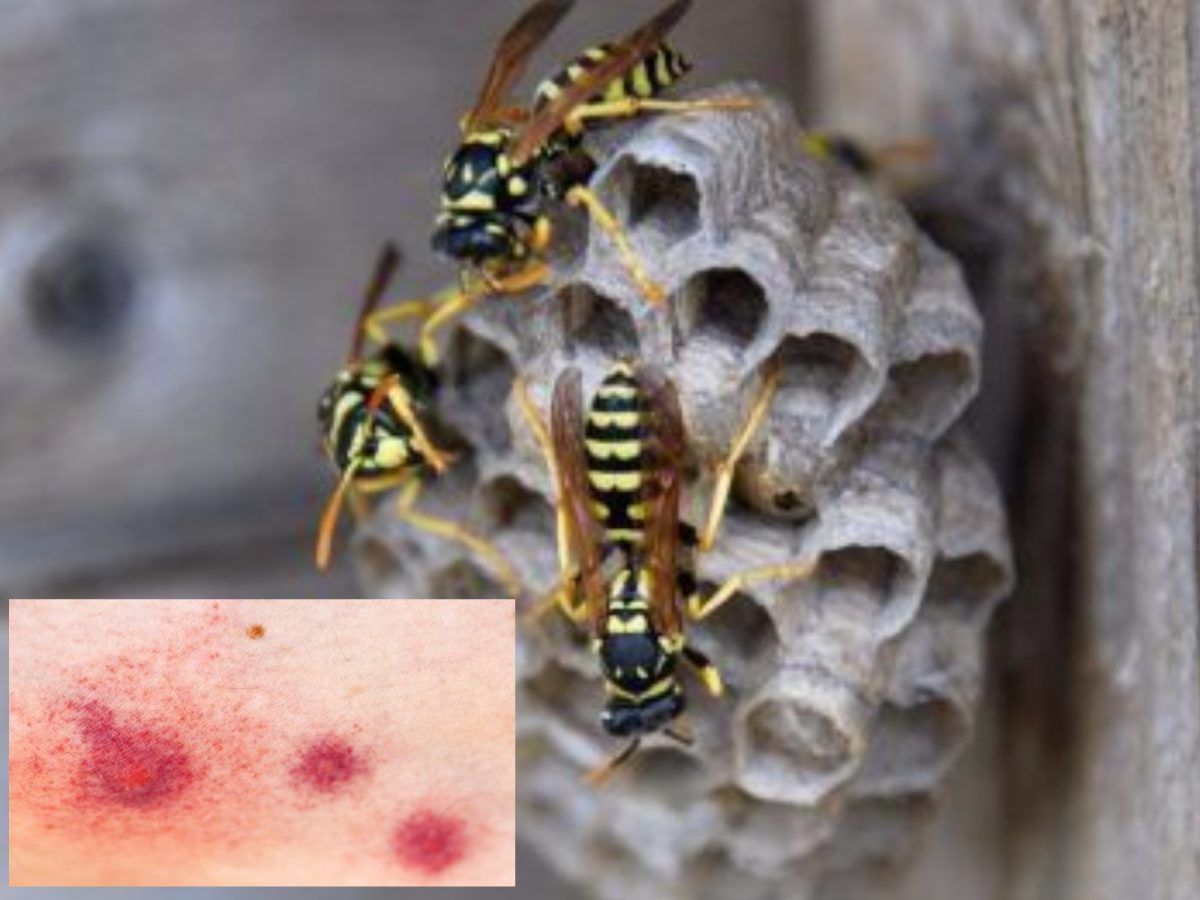 Πώς να προλάβεις τα έντομα που προκαλούν αλλεργίες και δερματικά προβλήματα