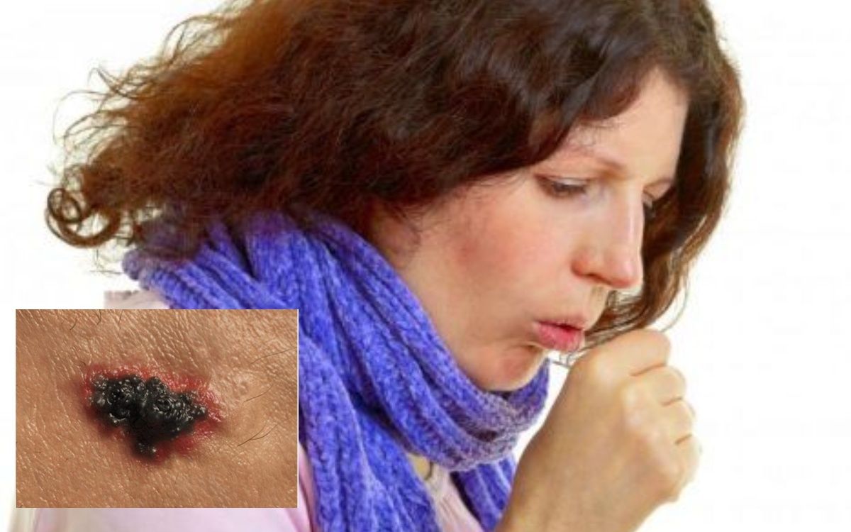 Πρώιμα Σημάδια Καρκίνου: Τι να Προσέξετε