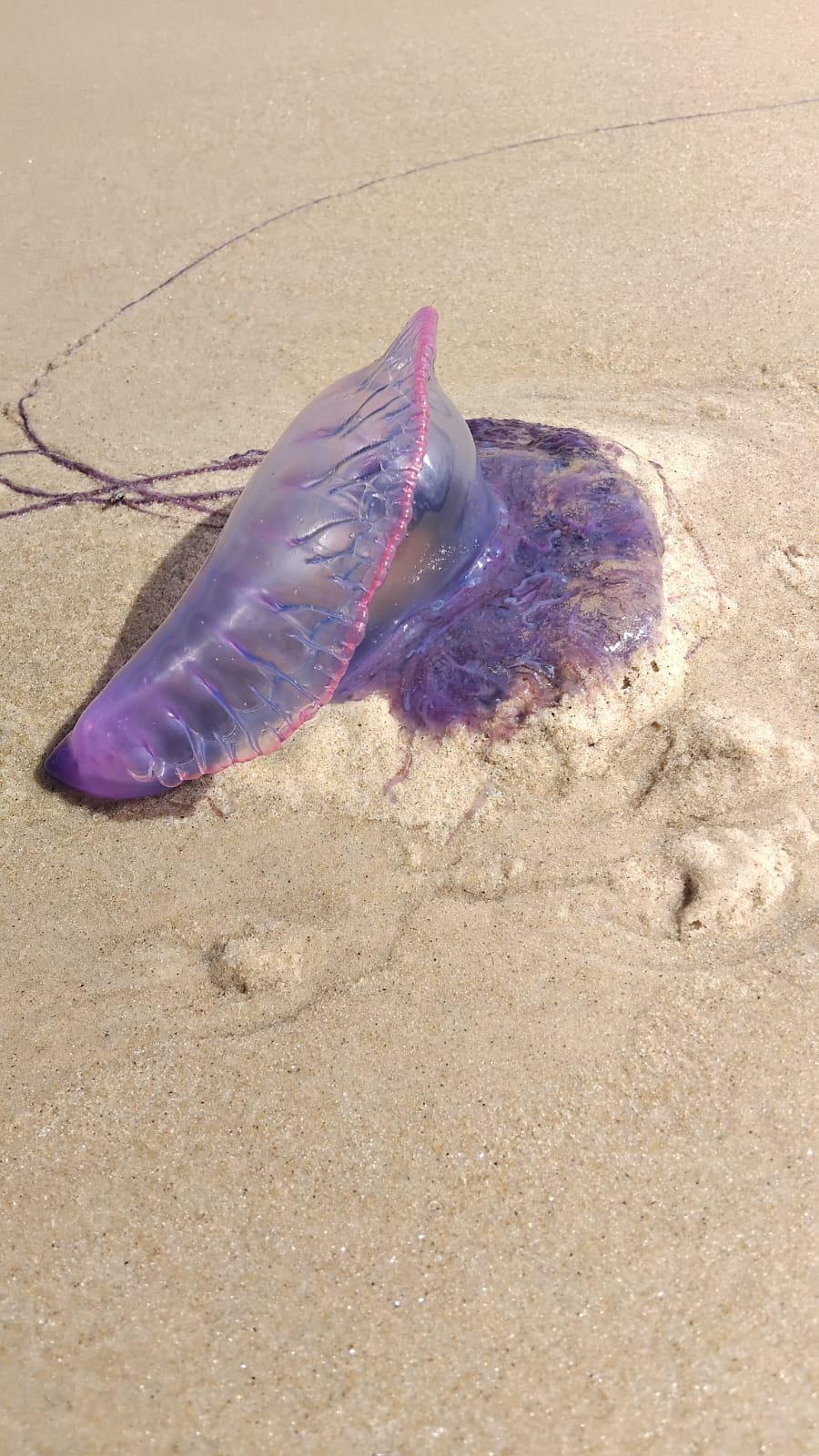 Τσίμπησε μωβ τσούχτρα το παιδί - Οδηγίες από Παιδίατρο και οι πρώτες βοήθειες που πρέπει να δώσεις