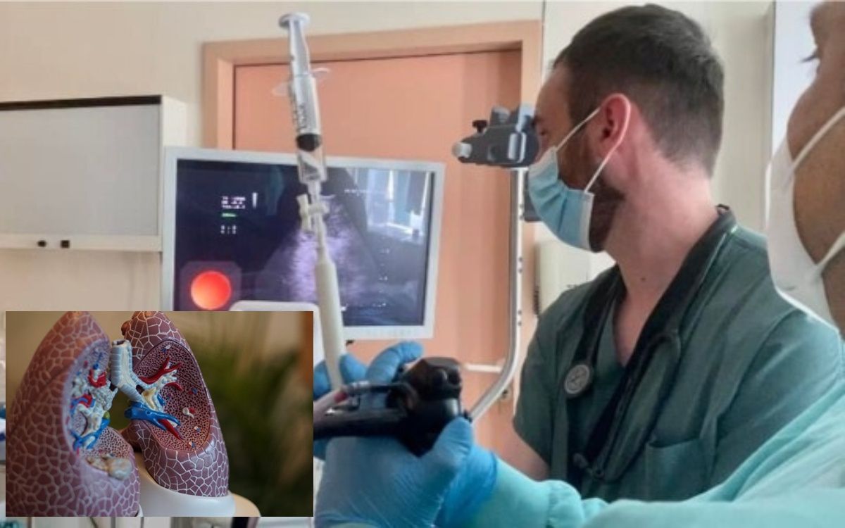 Βρογχοσκόπηση - Όσα πρέπει να ξέρετε για την εξέταση που σώζει ζωές