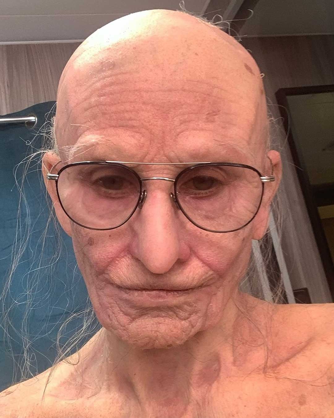 Αδιανόητη μεταμόρφωση πασίγνωστης σταρ του Hollywood - Από καλλονή έγινε γριά