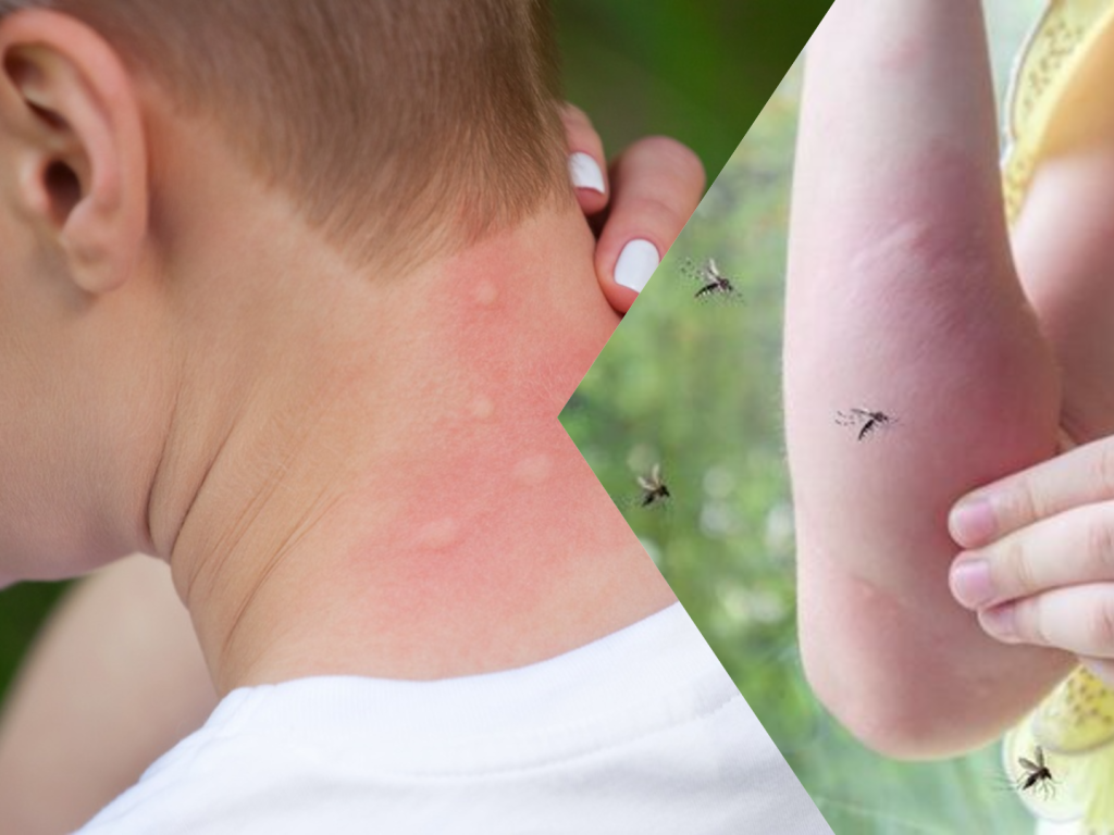 Δύο θάνατοι στην Ελλάδα από τον ιό του Δυτικού Νείλου - Οι περιοχές με τα περισσότερα κρούσματα