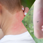 Δύο θάνατοι στην Ελλάδα από τον ιό του Δυτικού Νείλου - Οι περιοχές με τα περισσότερα κρούσματα