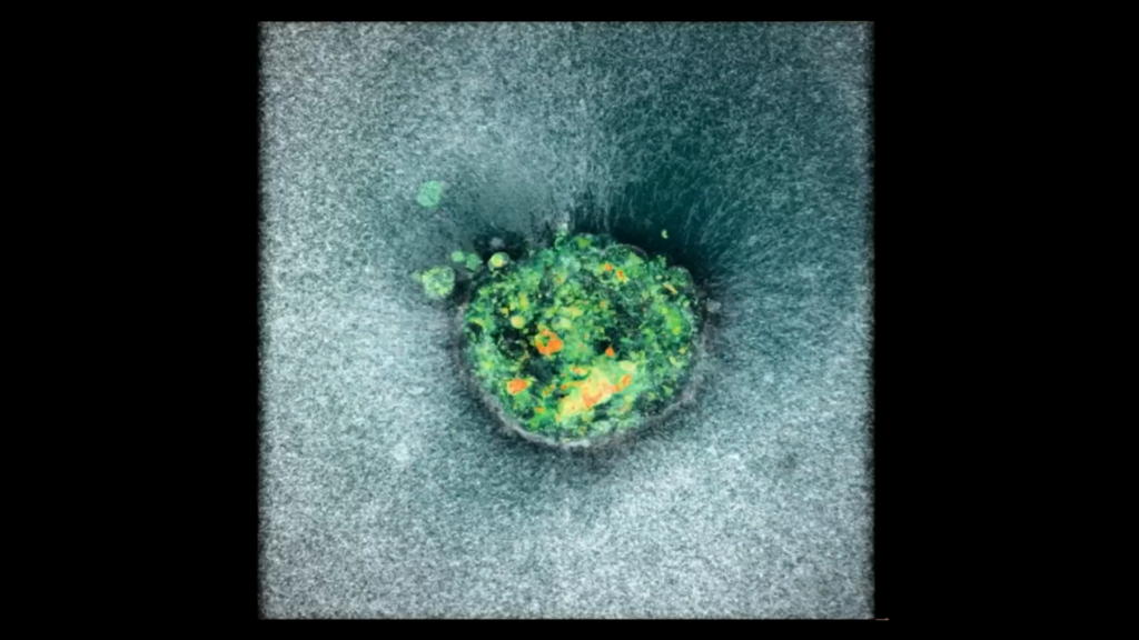 Ιστορική στιγμή: επιστήμονες κατάφεραν να καταγράψουν για πρώτη φορά σε βίντεο την εμφύτευση ανθρώπινου εμβρύου στη μήτρα