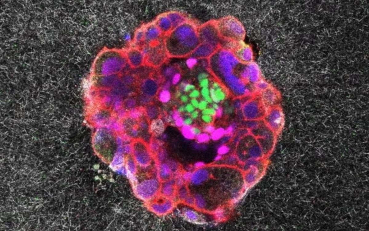 Ιστορική στιγμή: Επιστήμονες κατάφεραν να καταγράψουν για πρώτη φορά σε βίντεο την εμφύτευση ανθρώπινου εμβρύου στη μήτρα