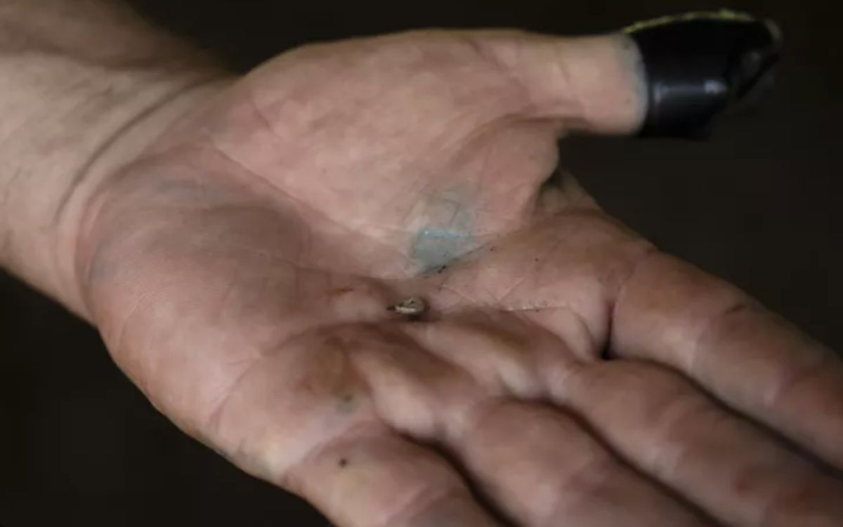 Σκουλήκι του Νέου Κόσμου: Επιβεβαιώθηκε το πρώτο κρούσμα σε άνθρωπο- Τι είναι και τι μπορεί να μας προκαλέσει