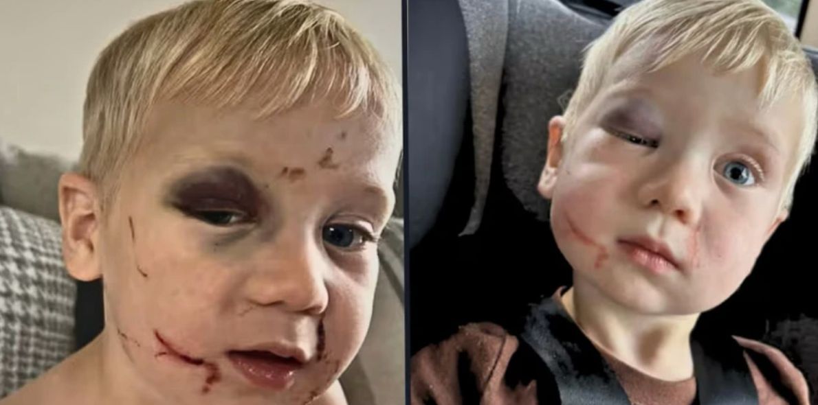 Οργή με κακοποίηση ανηλίκου: Εργαζόμενη σε παιδικό σταθμό σάπισε στο ξύλο ένα μωρό - Η Κατηγορούμενη αφέθηκε ελεύθερη (Φωτογραφίες)