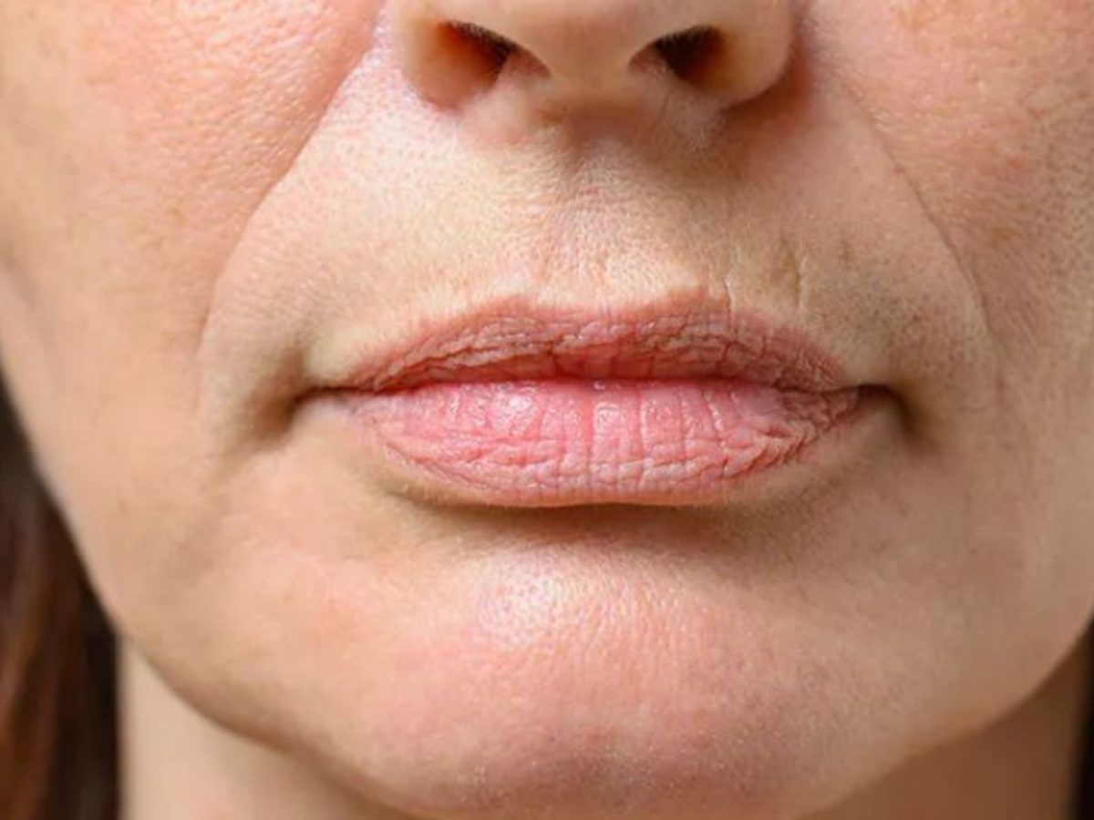 Σπιτική κρέμα με κολλαγόνο: Η κρέμα νυχτός που θα σβήσει τις ρυτίδες σας & θα σας κάνει να φαίνεστε 10 χρόνια νεότερες