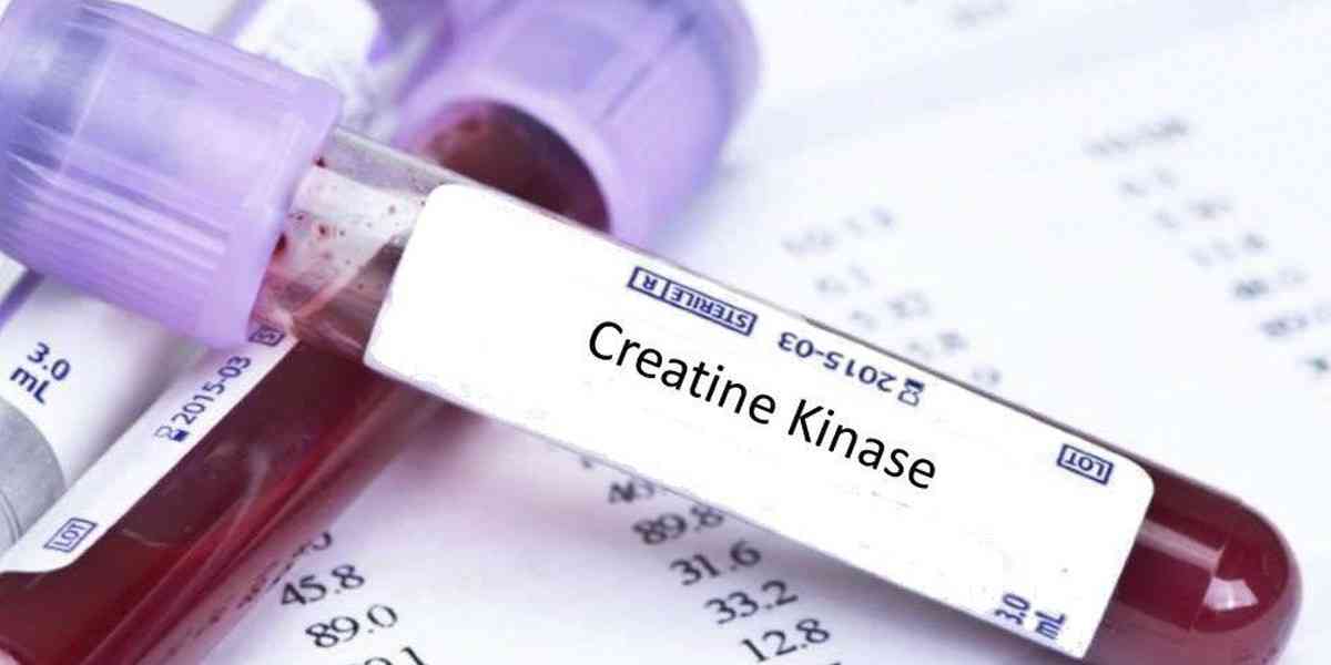 Αυξημένο CPK: Ποια προβλήματα υγείας φανερώνει και πότε πρέπει να ανησυχήσουμε;