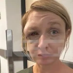 Κορωπί: Έχουμε σχέση αγάπης-Οι Δηλώσεις στην κάμερα από την 40χρονη που ξυλοκοπήθηκε άγρια από τον σύντροφό της