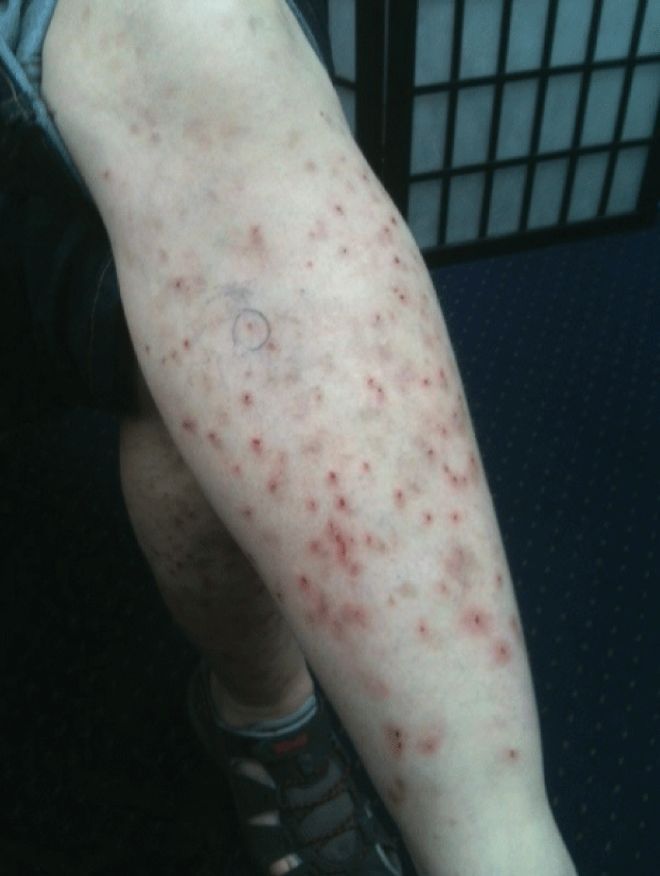 Οι πιο σπάνιες και φονικές ασθένειες για τον άνθρωπο