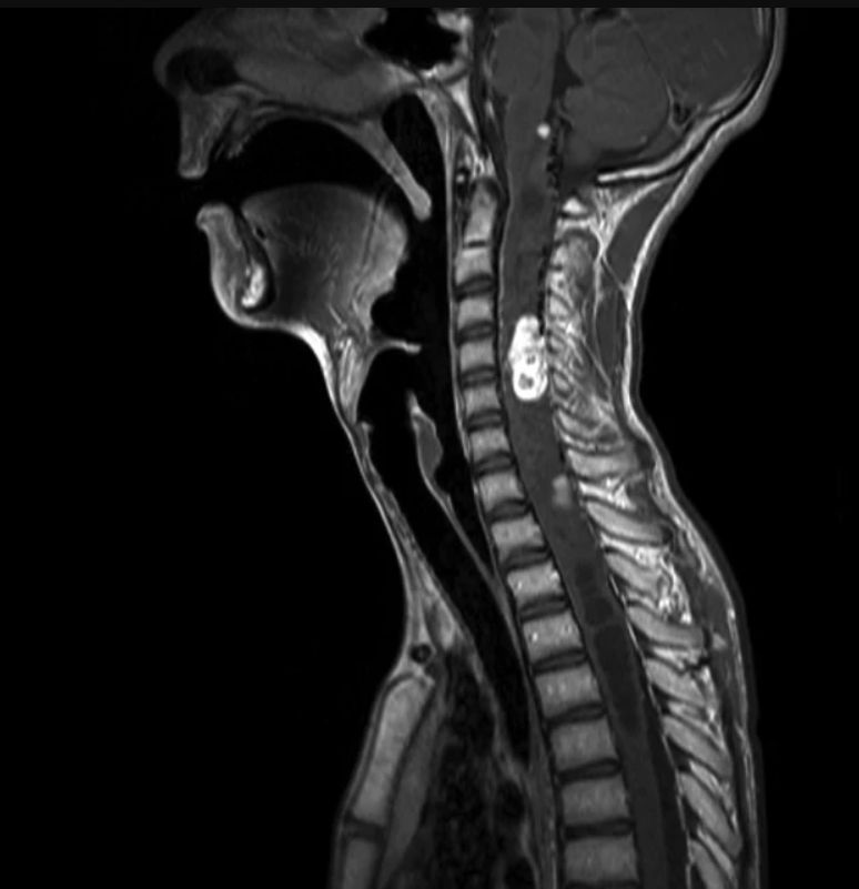 Οι πιο σπάνιες και φονικές ασθένειες για τον άνθρωπο