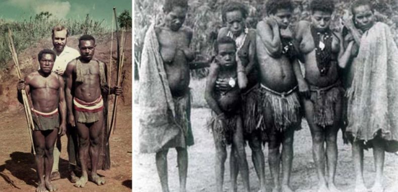 Οι πιο σπάνιες και φονικές ασθένειες για τον άνθρωπο