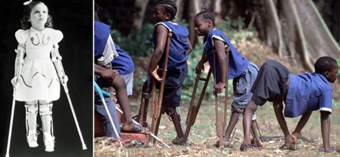 Οι πιο σπάνιες και φονικές ασθένειες για τον άνθρωπο