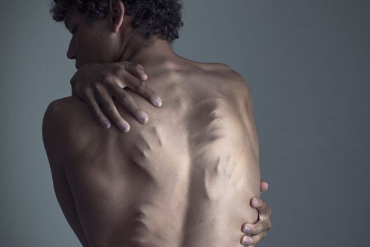 Όταν το στόμα δεν αρθρώνει λέξη το σώμα ουρλιάζει από πόνο